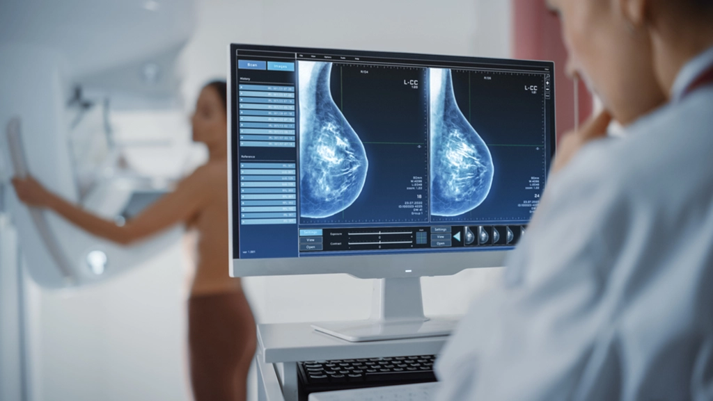 What Is Dense Breast Tissue?