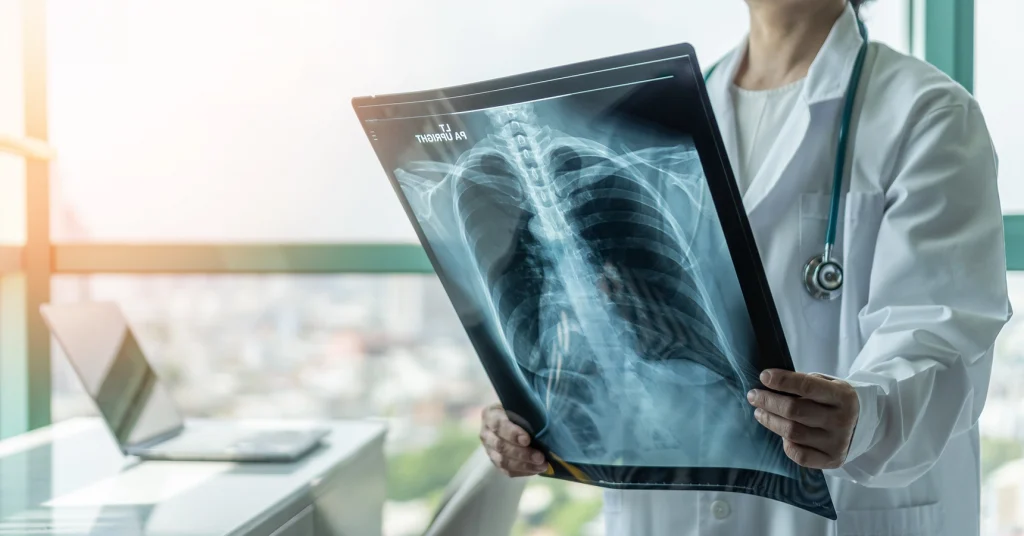Female Technologist Views Patient's Chest X-Ray Results